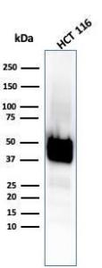 Anti-Cytokeratin 8 antibody