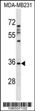 Anti-AURKC Rabbit Polyclonal Antibody