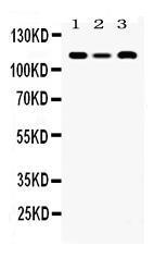 Anti-HLTF Rabbit Polyclonal Antibody