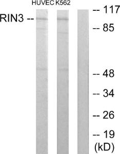 Western blot analysis of lysates from HUVEC and K562 cells using Anti-RIN3 Antibody. The right hand lane represents a negative control, where the antibody is blocked by the immunising peptide.