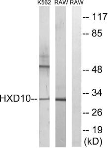 Western blot analysis of lysates from K562 and RAW2647 cells using Anti-HOXD10 Antibody The right hand lane represents a negative control, where the antibody is blocked by the immunising peptide