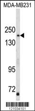 Anti-TBC1D4 Rabbit Polyclonal Antibody