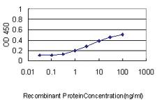 Anti-ATP7B Mouse Monoclonal Antibody [clone: 3E10]