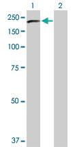 Anti-PLCG2 Rabbit Polyclonal Antibody