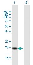 Anti-AP3S2 Mouse Polyclonal Antibody