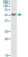 Anti-TRAF1 Antibody Pair