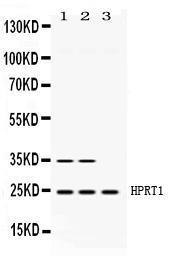 Anti-HPRT1 Rabbit Polyclonal Antibody