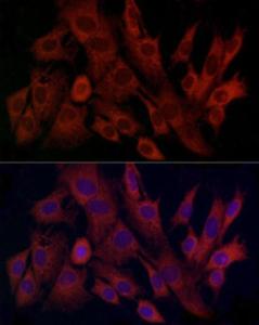 Anti-TIMM8A/DDP antibody