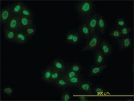 Anti-HDAC1 Mouse Monoclonal Antibody [clone: 5A11]