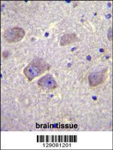 Anti-WDR27 Rabbit Polyclonal Antibody (FITC (Fluorescein Isothiocyanate))