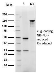 SDS-PAGE analysis of Anti-GLUT1 Antibody [rGLUT1/2476] under non-reduced and reduced conditions; showing intact IgG and intact heavy and light chains, respectively. SDS-PAGE analysis confirms the integrity and purity of the antibody