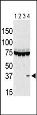 Anti-AURKC Rabbit Polyclonal Antibody