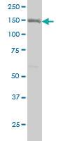 Anti-ITGA2 Mouse Monoclonal Antibody [clone: 2B6]