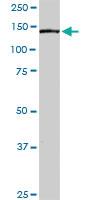 Anti-PLCG2 Rabbit Polyclonal Antibody