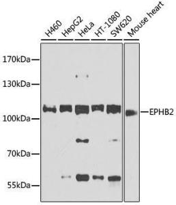 Western blot analysis of extracts of various cell lines, using Anti-Eph receptor B2 Antibody (A12398) at 1:1,000 dilution