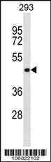 Anti-AURKC Rabbit Polyclonal Antibody