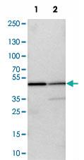 Anti-KLHDC8B Rabbit Polyclonal Antibody