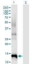 Anti-CDKN2B Mouse Monoclonal Antibody [clone: 8C4]