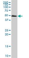 Anti-MAPKAPK5 Mouse Polyclonal Antibody