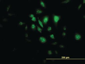 Anti-STK33 Mouse Monoclonal Antibody [clone: 3F10]