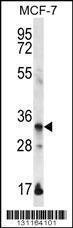 Anti-EVPLL Rabbit Polyclonal Antibody (APC (Allophycocyanin))