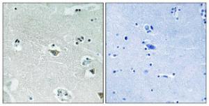 Immunohistochemical analysis of paraffin-embedded human brain using Anti-SREBP-1 (phospho Ser439) Antibody. The right hand panel represents a negative control, where the antibody was pre-incubated with the immunising peptide