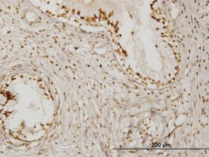 Anti-KLHDC4 Mouse Monoclonal Antibody [clone: 4G11]