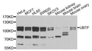 Western blot analysis of extracts of various cell lines, using Anti-UBTF Antibody (A9847) at 1:1,000 dilution