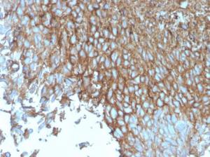 Immunohistochemical analysis of formalin-fixed, paraffin-embedded human bladder using Anti-GLUT1 Antibody [rGLUT1/2476]