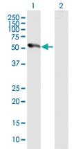 Anti-MAPKAPK5 Mouse Polyclonal Antibody