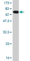 Anti-SPP1 Mouse Monoclonal Antibody [clone: 4E6]