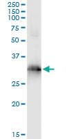 Anti-HOXB9 Antibody Pair