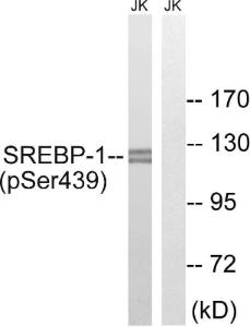 Western blot analysis of lysates from Jurkat cells treated with TNF 20 ng/ml 30' using Anti-SREBP-1 (phospho Ser439) Antibody. The right hand lane represents a negative control, where the antibody is blocked by the immunising peptide