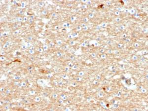 Immunohistochemical analysis of formalin-fixed, paraffin-embedded human brain using Anti-Drebrin Antibody [DBN1/2880]