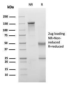 SDS-PAGE analysis of Anti-VISTA Antibody [VISTA/3006] under non-reduced and reduced conditions; showing intact IgG and intact heavy and light chains, respectively. SDS-PAGE analysis confirms the integrity and purity of the antibody