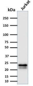 Western blot analysis of human Jurkat cell lysate using Anti-CD3 epsilon Antibody [C3e/2478]