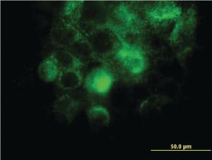 Anti-ITGA2 Mouse Monoclonal Antibody [clone: 2B6]