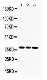 Anti-LDHB Rabbit Polyclonal Antibody