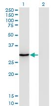 Anti-ORC6 Mouse Monoclonal Antibody [clone: 3C4]