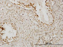 Anti-KLHDC4 Mouse Monoclonal Antibody [clone: 4G11]