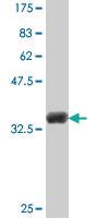 Anti-CMPK1 Mouse Polyclonal Antibody