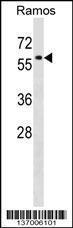 Anti-P4HA1 Rabbit Polyclonal Antibody (Biotin)