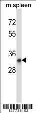 Anti-TATDN1 Rabbit Polyclonal Antibody (APC (Allophycocyanin))