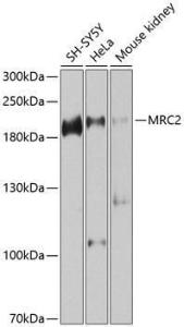 Western blot analysis of extracts of various cell lines, using Anti-MRC2/ENDO180 Antibody (A12405) at 1:1000 dilution. The secondary Antibody was Goat Anti-Rabbit IgG H&L Antibody (HRP) at 1:10000 dilution. Lysates/proteins were present at 25 µg per lane