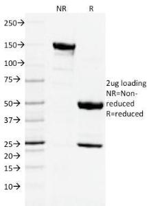 SDS-PAGE analysis of Anti-CD3 epsilon Antibody [C3e/2478] under non-reduced and reduced conditions; showing intact IgG and intact heavy and light chains, respectively. SDS-PAGE analysis confirms the integrity and purity of the antibody