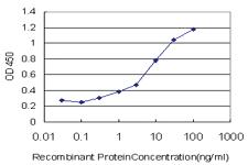 Anti-PLEC Mouse Monoclonal Antibody [clone: 4D12]