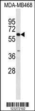 Anti-CES5A Rabbit Polyclonal Antibody (APC (Allophycocyanin))