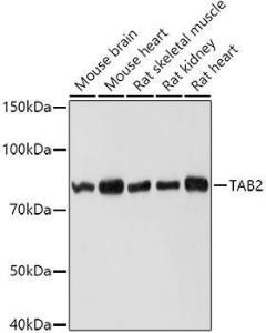 Anti-TAB2 antibody