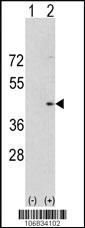 Anti-AURKA Rabbit Polyclonal Antibody