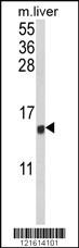 Anti-CCL3 Rabbit Polyclonal Antibody